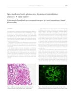 IgA-mediated anti-glomerular basement membrane disease. A case report.